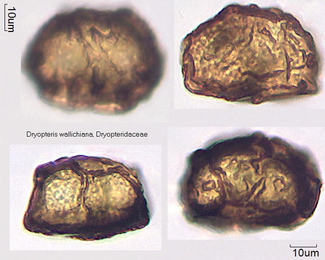 Sporen von Dryopteris wallichiana, 19-074