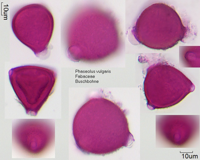 Pollen von Phaseolus vulgaris
