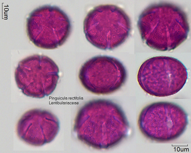 Pollen von Pinguicula rectifolia