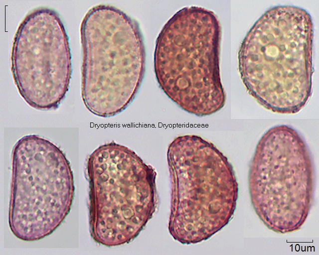 Sporen von Dryopteris wallichiana, 19-074-1