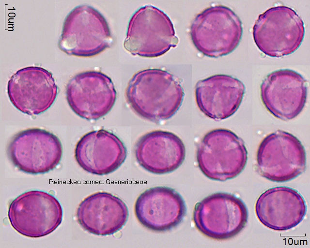 Pollen von Sphaerorrhiza sarmentiana