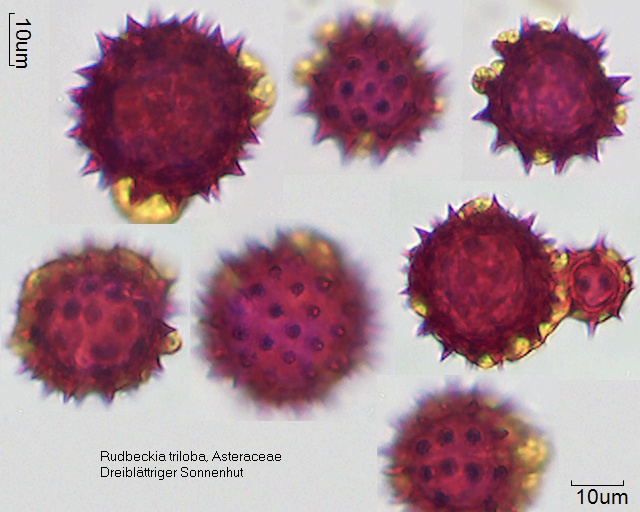 Pollen von Rudbeckia triloba, Präparat 20-028