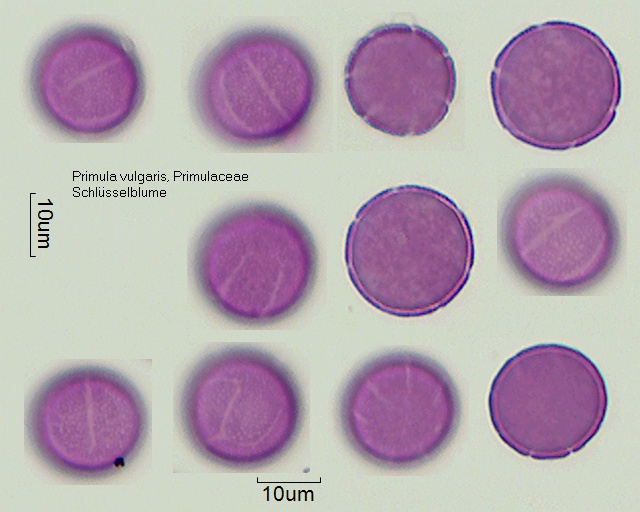 Pollen von Primula vulgaris