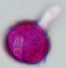 Datei:Papaver miyabeanum Pollenschlauch.jpg