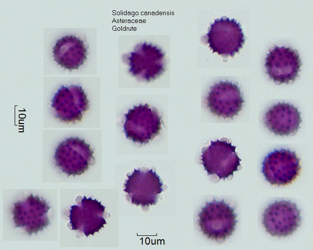 Pollen von Solidago canadensis