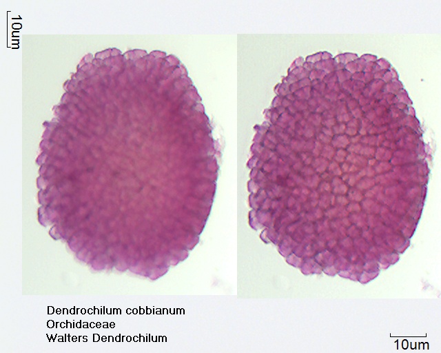 Polyad - Pollinium von Dendrochilum cobbianum
