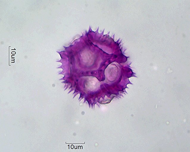 Pollen von Cichorium intybus
