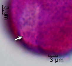 Datei:Papaver miyabeanum Pollenschlauch 1.jpg