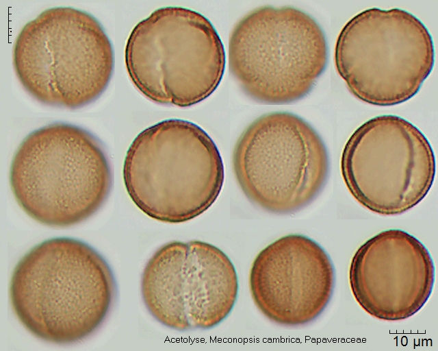 Acetolysierter Pollen von Meconopsis cambrica, 7-016-1
