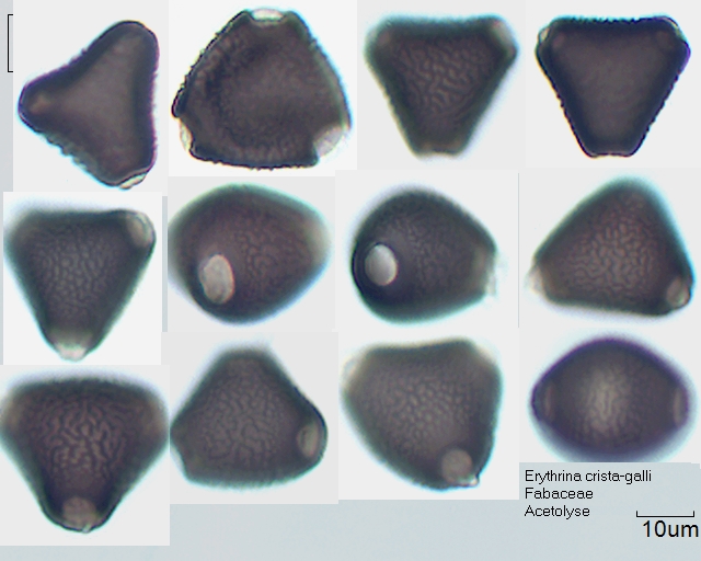 Acetolysierter Pollen von Erythrina crista-galli, 2-015-1