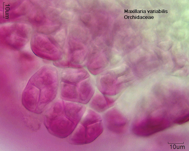 Datei:Maxillaria variabilis (1).jpg