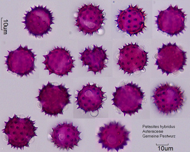 Pollen von Petasites hybridus.jpg