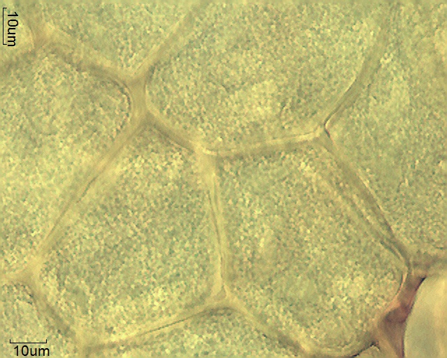 Zellen des Polliniums von Asclepias syriaca