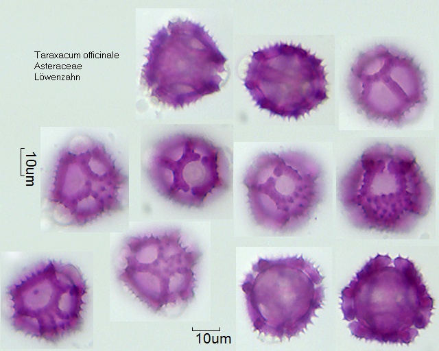 Pollen von Taraxacum officinale