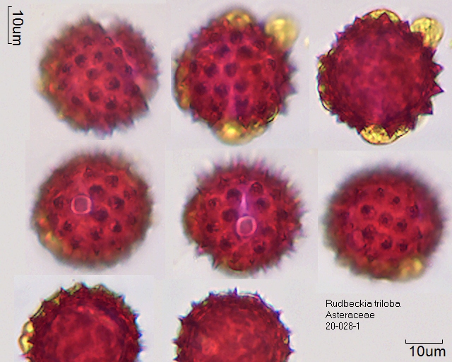 Pollen von Rudbeckia triloba, Präparat 20-028-1