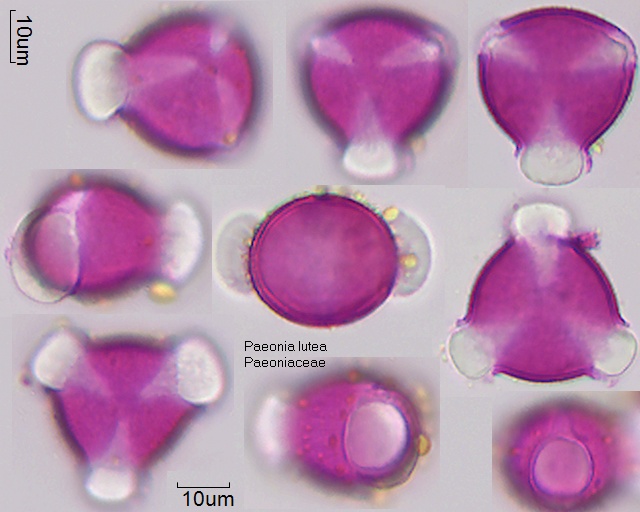 Pollen von Paeonia lutea
