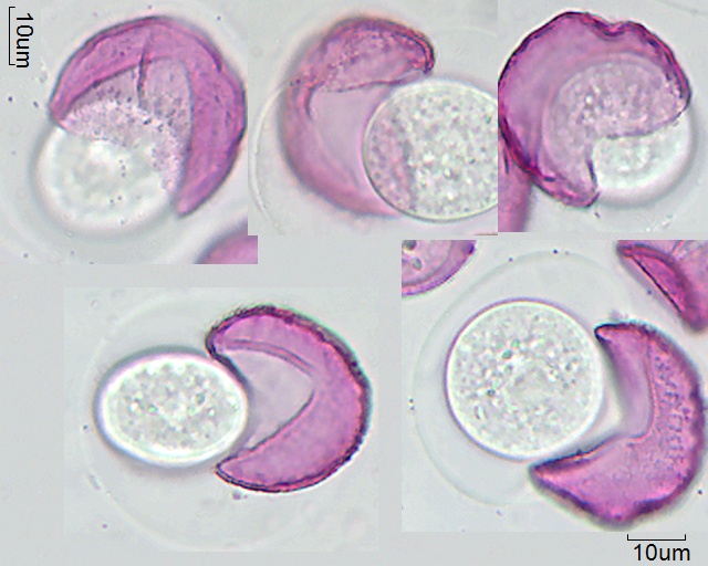 Geplatzte Pollen von Taxodium distichum