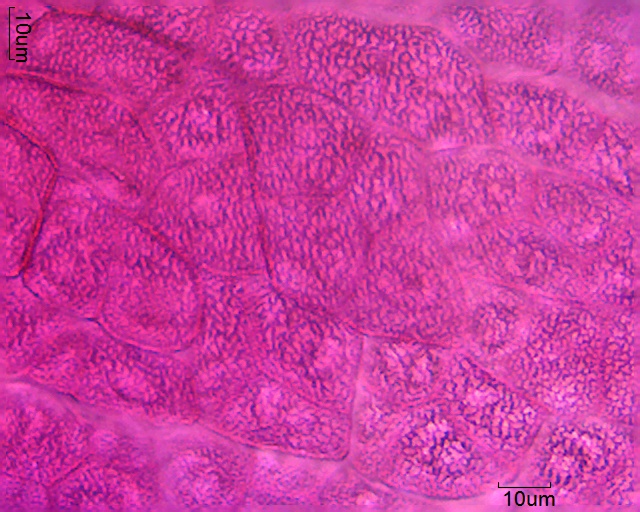 Datei:Dactylorhiza maculata (3).jpg