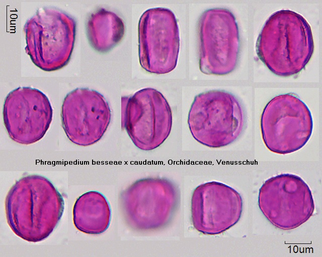 Pollen von Phragmipedium sargentianum
