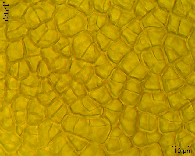 Tetraden im Pollinium von Erycina pusilla