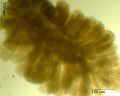Anacamptis laxiflora Pollinium.jpg