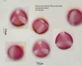 Ranunculus-ficaria (1).jpg