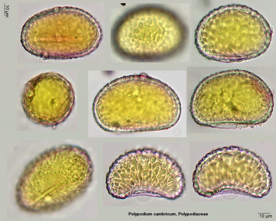 Sporen von Polypodium cambricum