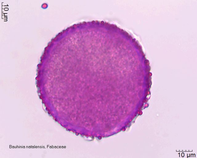 Pollen von Bauhinia natalensis in Fuchsin-Glyceringelatine, 25-006