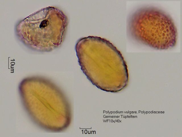 Sporen von Polypodium vulgare