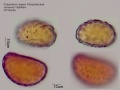 Polypodium vulgare (2).jpg
