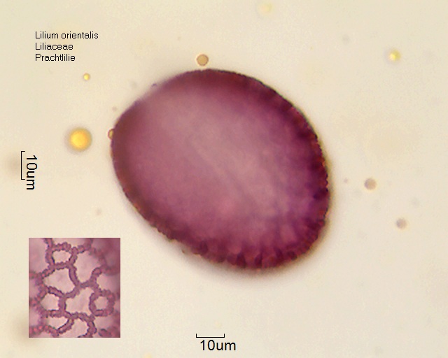 Pollen von Lilium orientalis