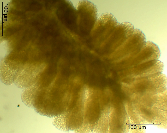 Pollinium von Anacamptis laxiflora