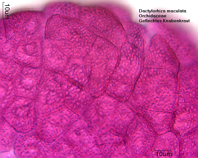 Datei:Dactylorhiza maculata (4).jpg