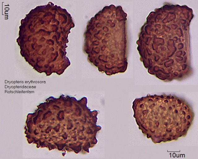 Sporen von Dryopteris erythrosora