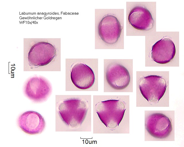 Pollen von Laburnum anagyroides