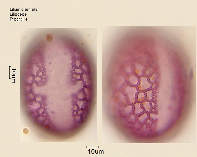 Pollen von Lilium orientalis (2).jpg