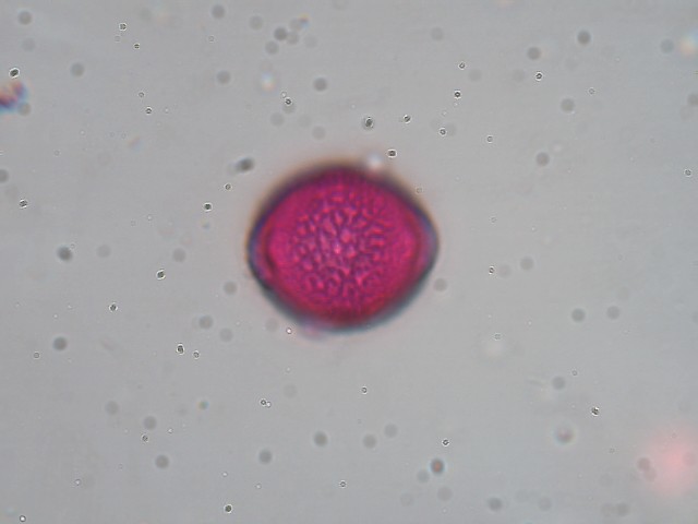 Pollen von Viburnum lantana