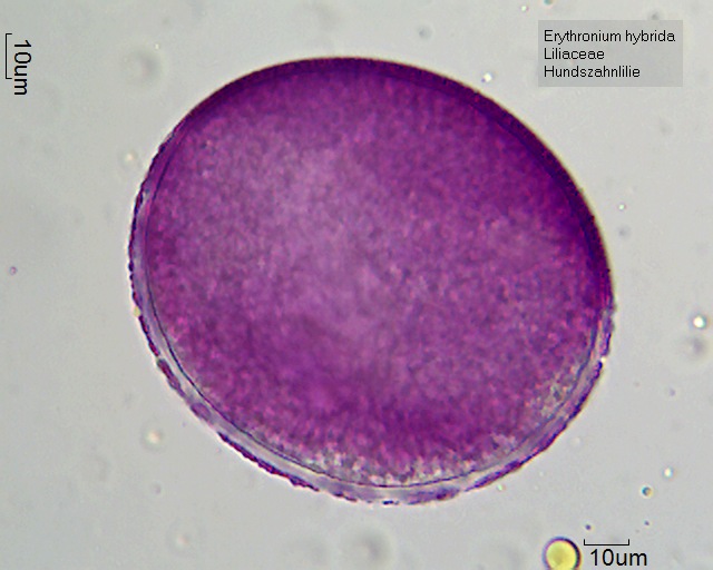 Pollen von Erythronium hybrida