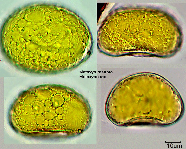Sporen von Metaxya rostrata