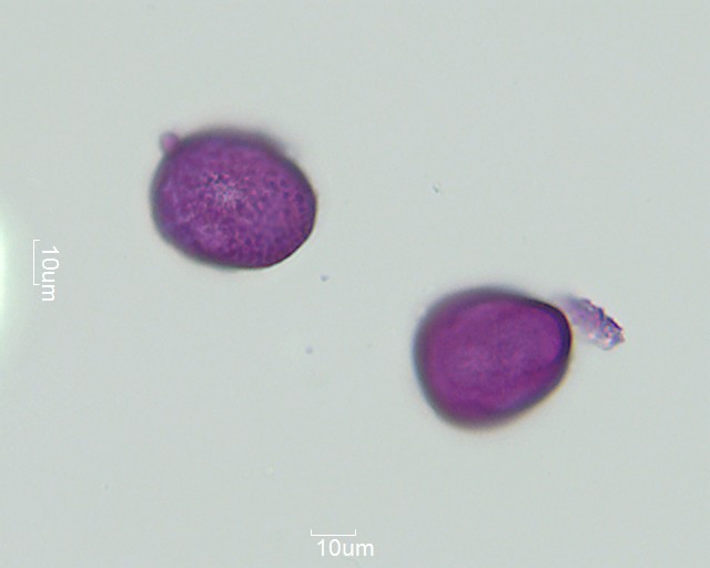 Pollen von Carex species, Präparat 1-062