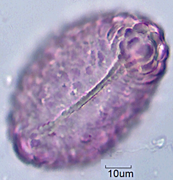 Datei:Polypodium vulgare monolet (4).jpg