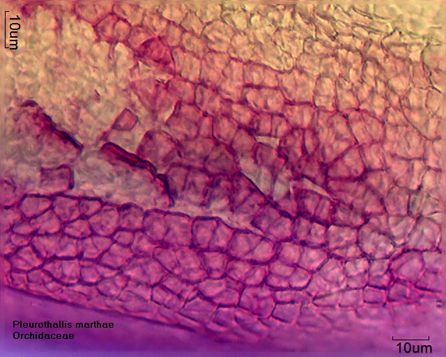 Zellen des Polliniums von Pleurothallis marthae