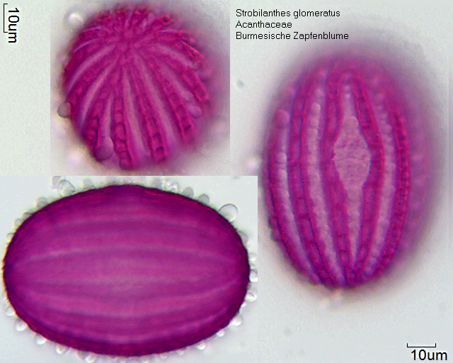 Pollen von Strobilanthes glomeratus
