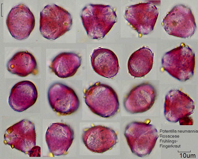 Pollen von Potentilla neumanniana