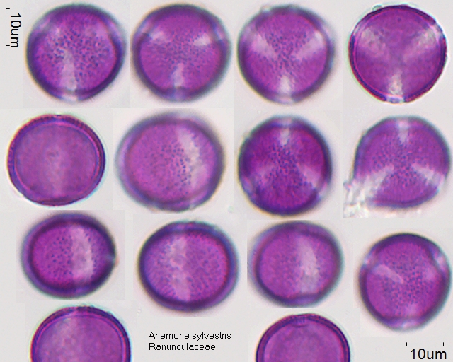 Pollen von Anemone sylvestris