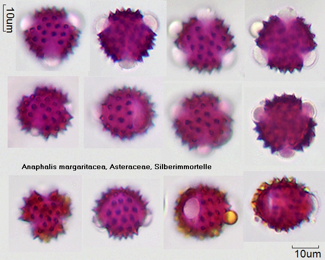 Pollen von Anaphalis margaritacea
