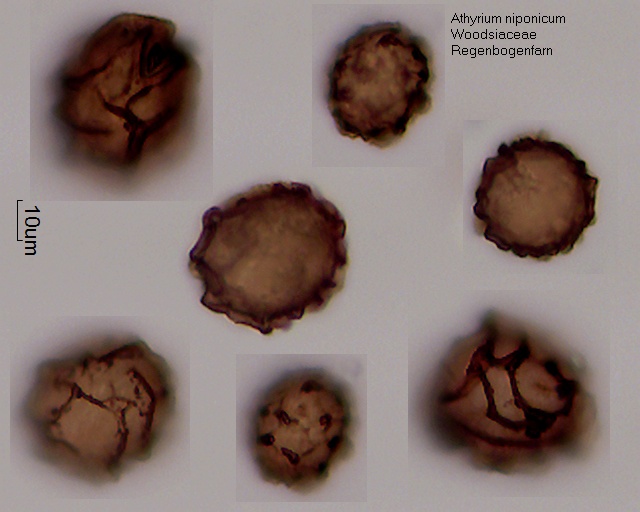 Sporen von Athyrium niponicum