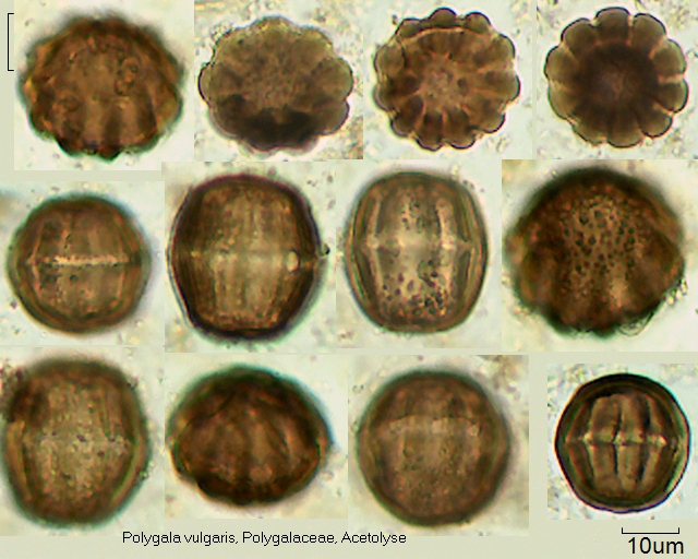 Acetolysierter Pollen von Polygala vulgaris, Nr. 23-087