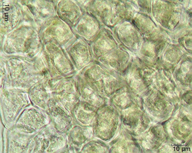 Tetraden im Pollinium von Erycina pusilla