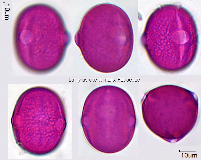 Pollen von Lathyrus occidentalis